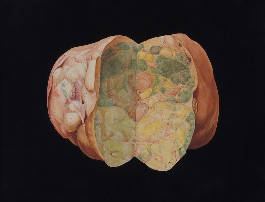 Brain-gut axis
